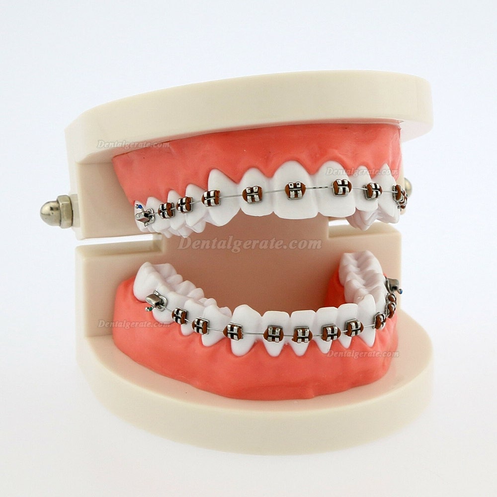 Dental Teach Typodont Demonstrationszahnmodell mit Zahnspangen F&uuml;r die Patientenstudie 5006